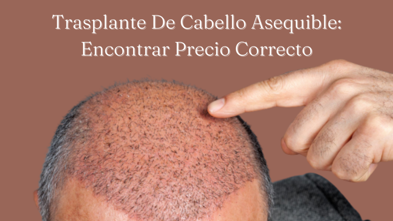 Trasplante De Cabello Asequible: Encontrar Precio Correcto
